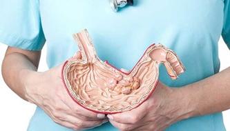 A doctor holds up an anatomical model of a stomach.