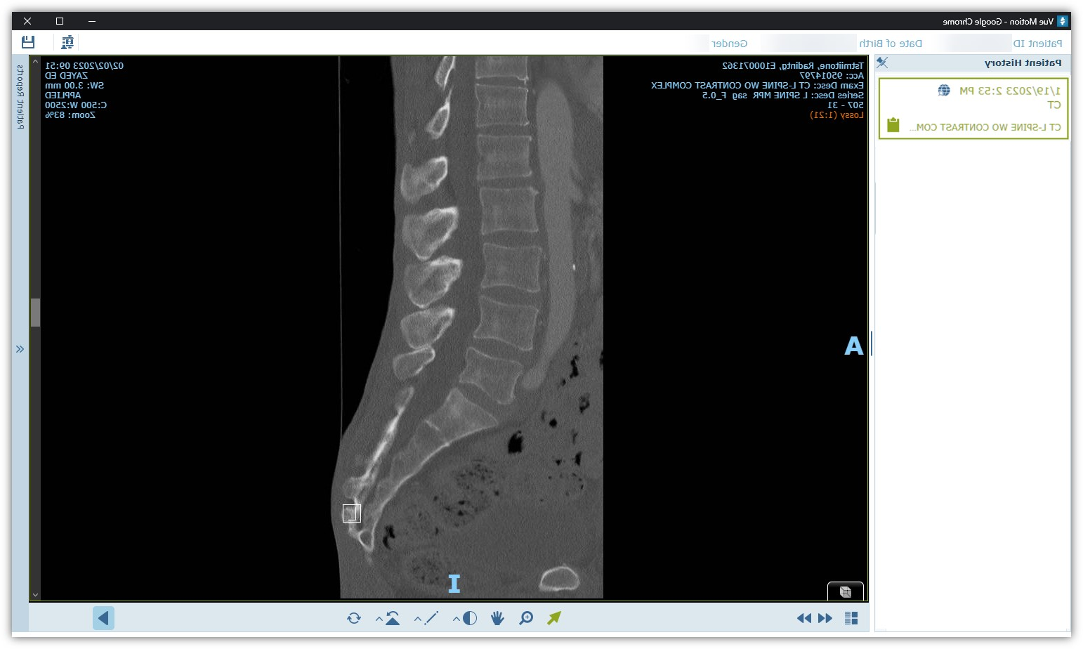 Screenshot of medical image